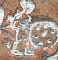 Symbol 1